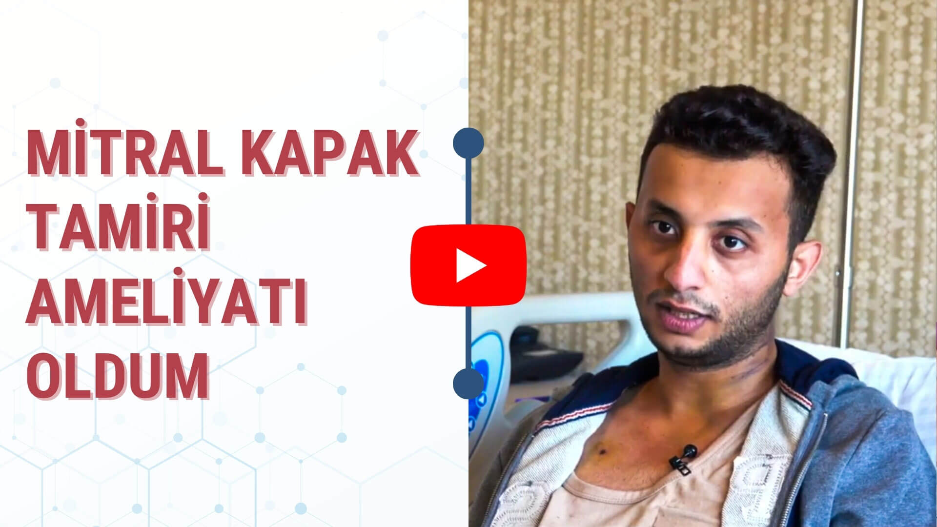 Hasta Yorumları: Mitral Kapak Tamiri